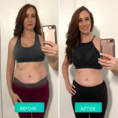 Skin Firming | Slimming Massage Device | Vibration Massage | Sculptiva