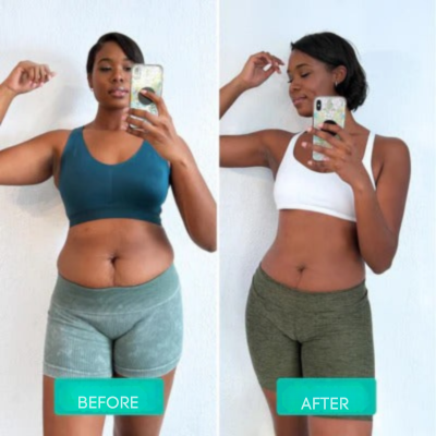 Skin Firming | Slimming Massage Device | Vibration Massage | Sculptiva