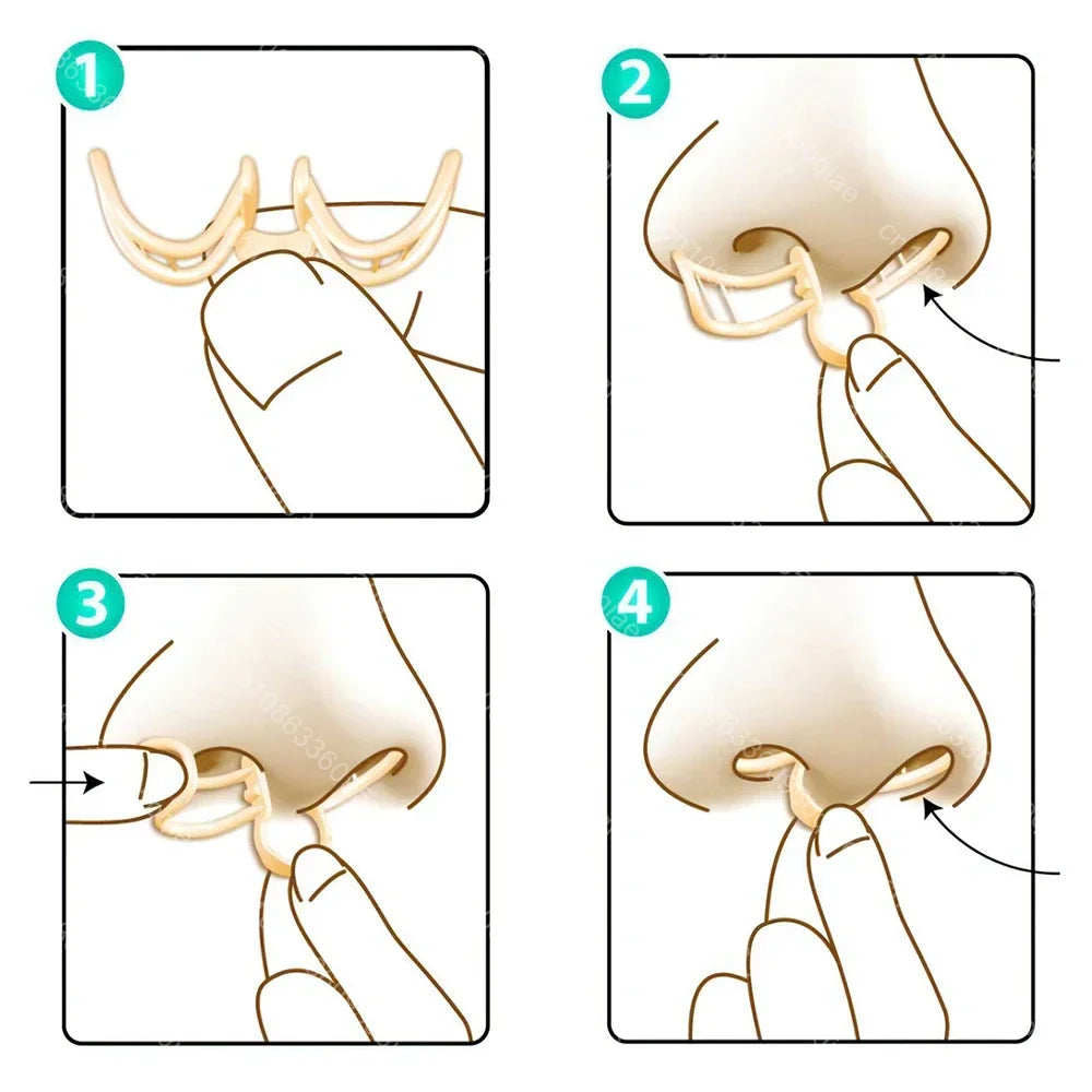 Comfortable Anti-Snoring Device – AirEase