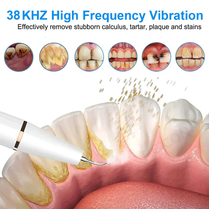 Ultrasonic Tooth Cleaner - SonicClean