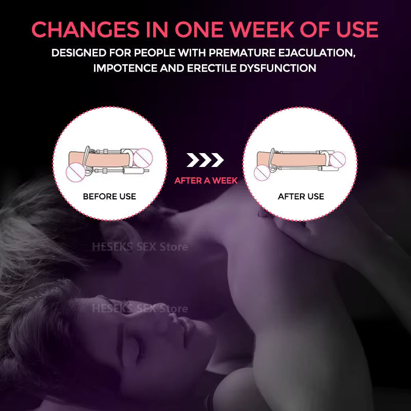 Quellix Traction Solution for Support and Enhancement
