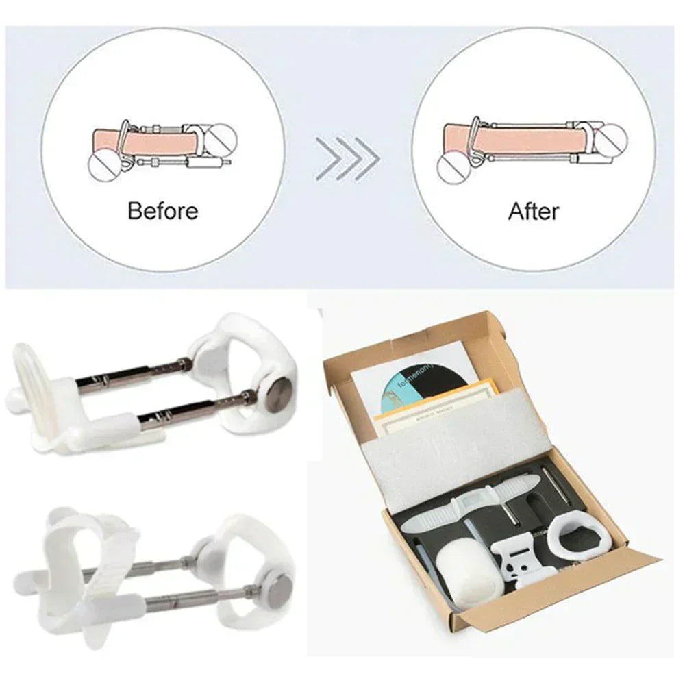 Quellix Traction Solution for Support and Enhancement