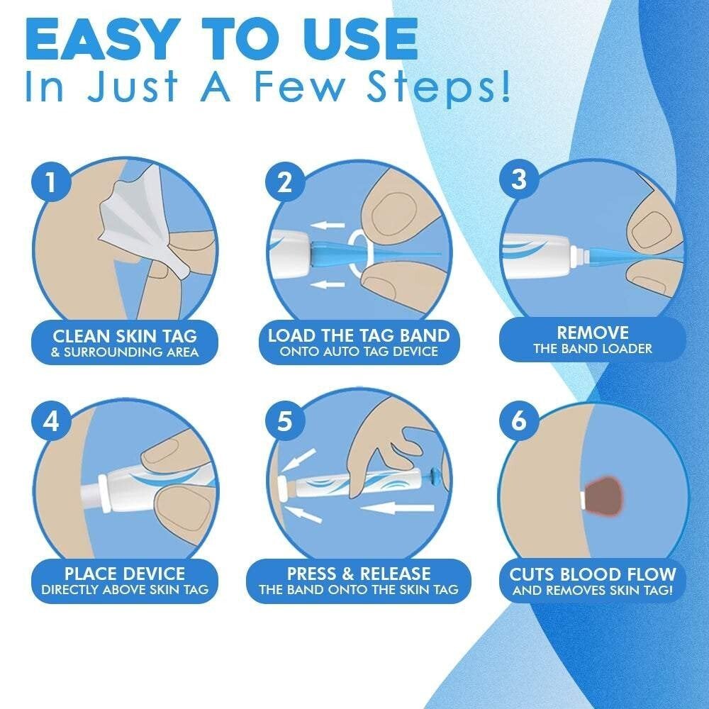 TagGone Automatic Skin Tag Removal Kit | Painless Application | For Smooth, Even Skin