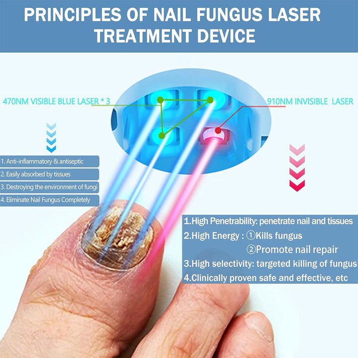 Easy-to-Use NexaLume Laser Nail Care Device