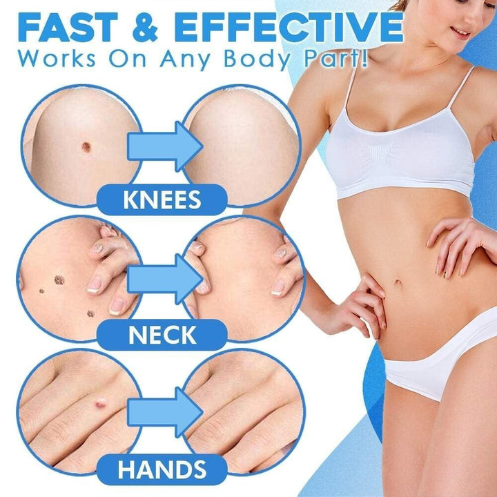 TagGone Automatic Skin Tag Removal Kit | Painless Application | For Smooth, Even Skin