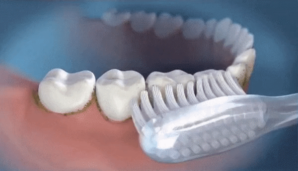 Water Flosser - Pain-Free Flossing | Three Colour Options