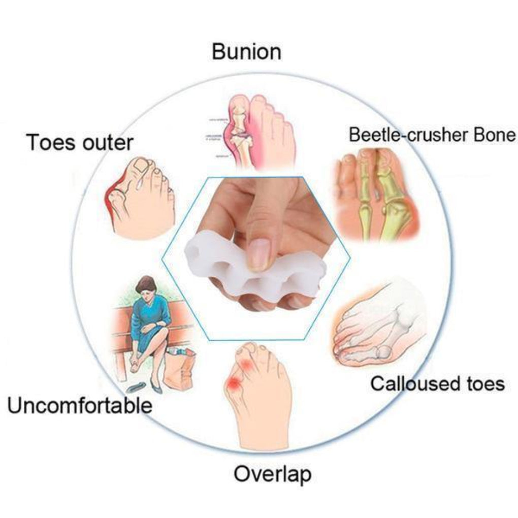 Designed for Balance Toe Corrector - Toe Separator