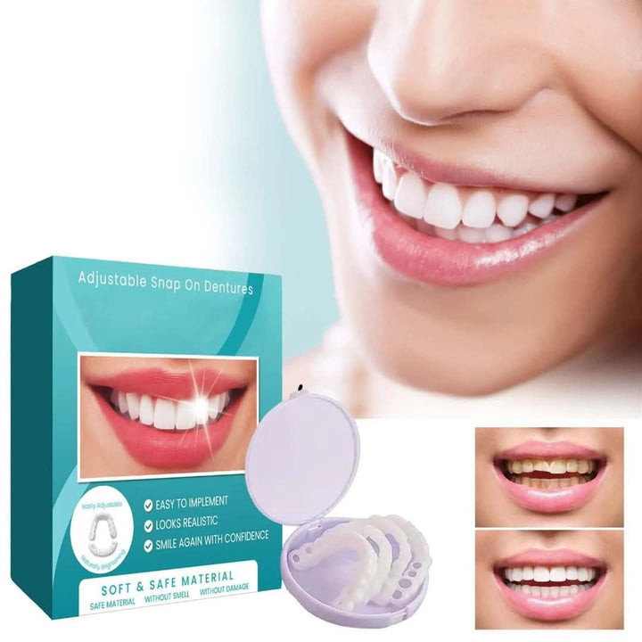 Snap-On Dental Veneers | Adjustable